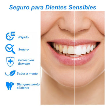 Kit profesional de blanqueamiento dental 3d White