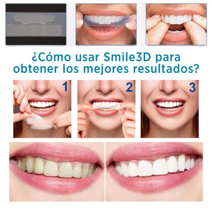 Kit profesional de blanqueamiento dental 3d White